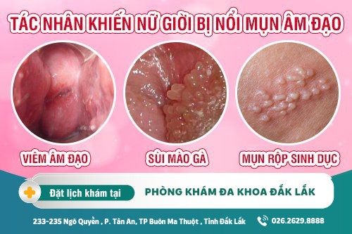 Dấu Hiệu Nổi Mụn Ở Vùng Kín Nữ? Có Mấy Loại Mụn Ở Vùng Kín?