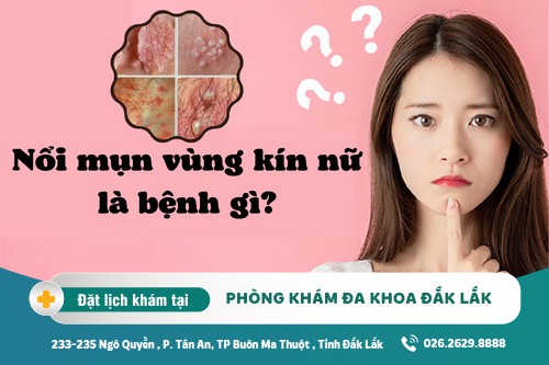 Nổi mụn nhọt ở vùng kín - căn bệnh khó nói của nhiều người